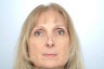 Revision Rhinoplasty