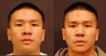 Revision Asian Rhinoplasty
