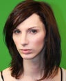 Rhinoplasty