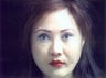 Rhinoplasty