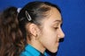 Rhinoplasty