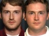 Rhinoplasty