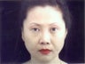 Rhinoplasty