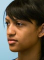 Nose Reshaping
