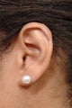 Keloid Removal