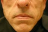 Sculptra