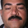 Reconstructive Septorhinoplasty