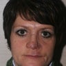 Reconstructive Septorhinoplasty
