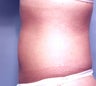 Slim Lipo