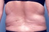Slim Lipo
