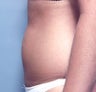 Slim Lipo