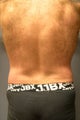 SmartLipo