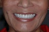 Smilemaker