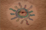 QSR Ruby Laser Tattoo Removal