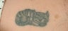 QSR Ruby Laser Tattoo Removal