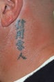 Tattoo Removal Before and After Pictures