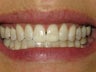 KOR Whitening