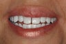 KOR Whitening