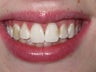 Kor Whitening