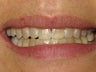 KOR Whitening
