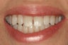 KOR Whitening
