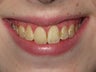 Kor Whitening