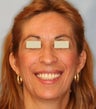 Dentures