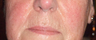 TriPollar