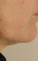 TriPollar