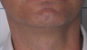 TriPollar
