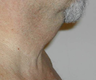 TriPollar