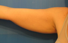 TriPollar