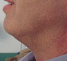 TriPollar