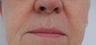 TriPollar