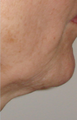 TriPollar