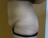TriPollar