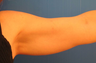TriPollar