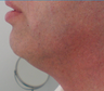 TriPollar