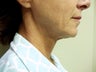 Ultherapy
