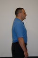 HCG Diet