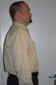 HCG Diet