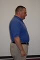 HCG Diet