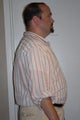 HCG Diet