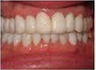Whiter Smile