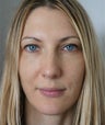 Cosmetic Injectables: Botox & Restylane L ~ 1CC Lower Eyelids
