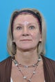 60-year-old female for 1st Botox Treatment