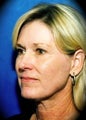 Laser Skin Resurfacing