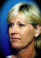 Laser Skin Resurfacing