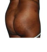 6 Month Post Operative Buttock Augmentation