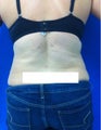 Laser Lipo
